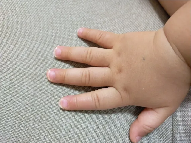 ほくろ占い」とは?顔・体のほくろの位置で占う性格・運勢 -セキララゼクシィ